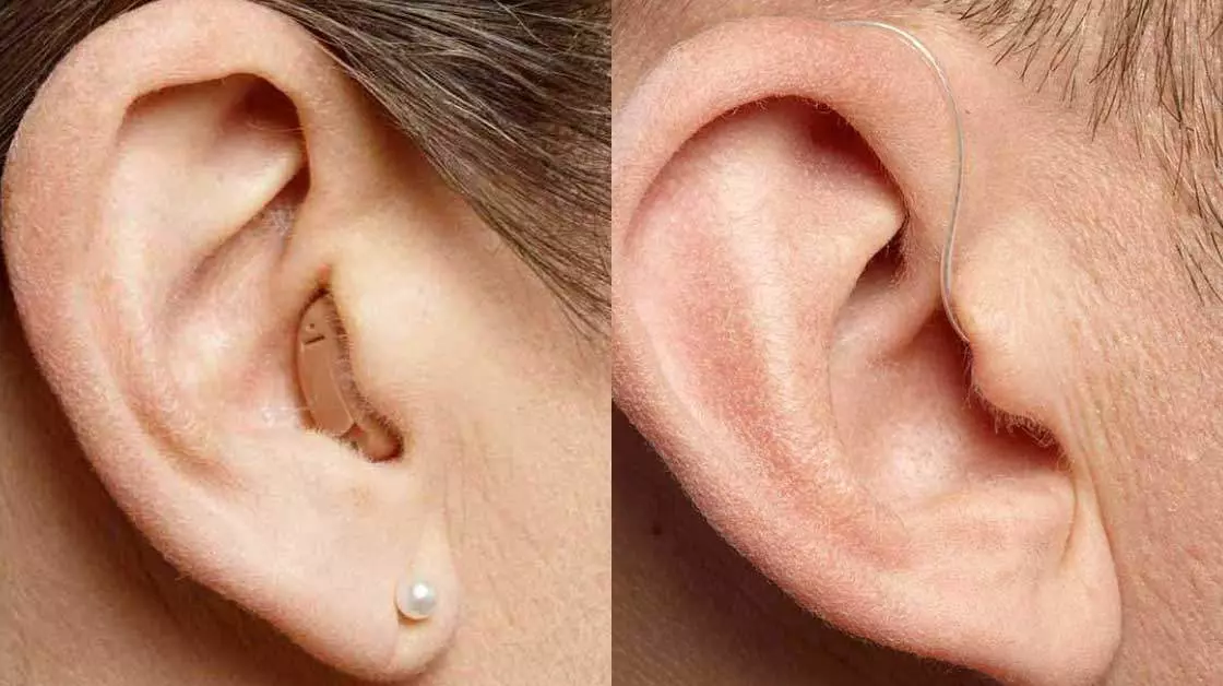 oticon isitme cihazi kulak ici ve arkasi gorunum farki