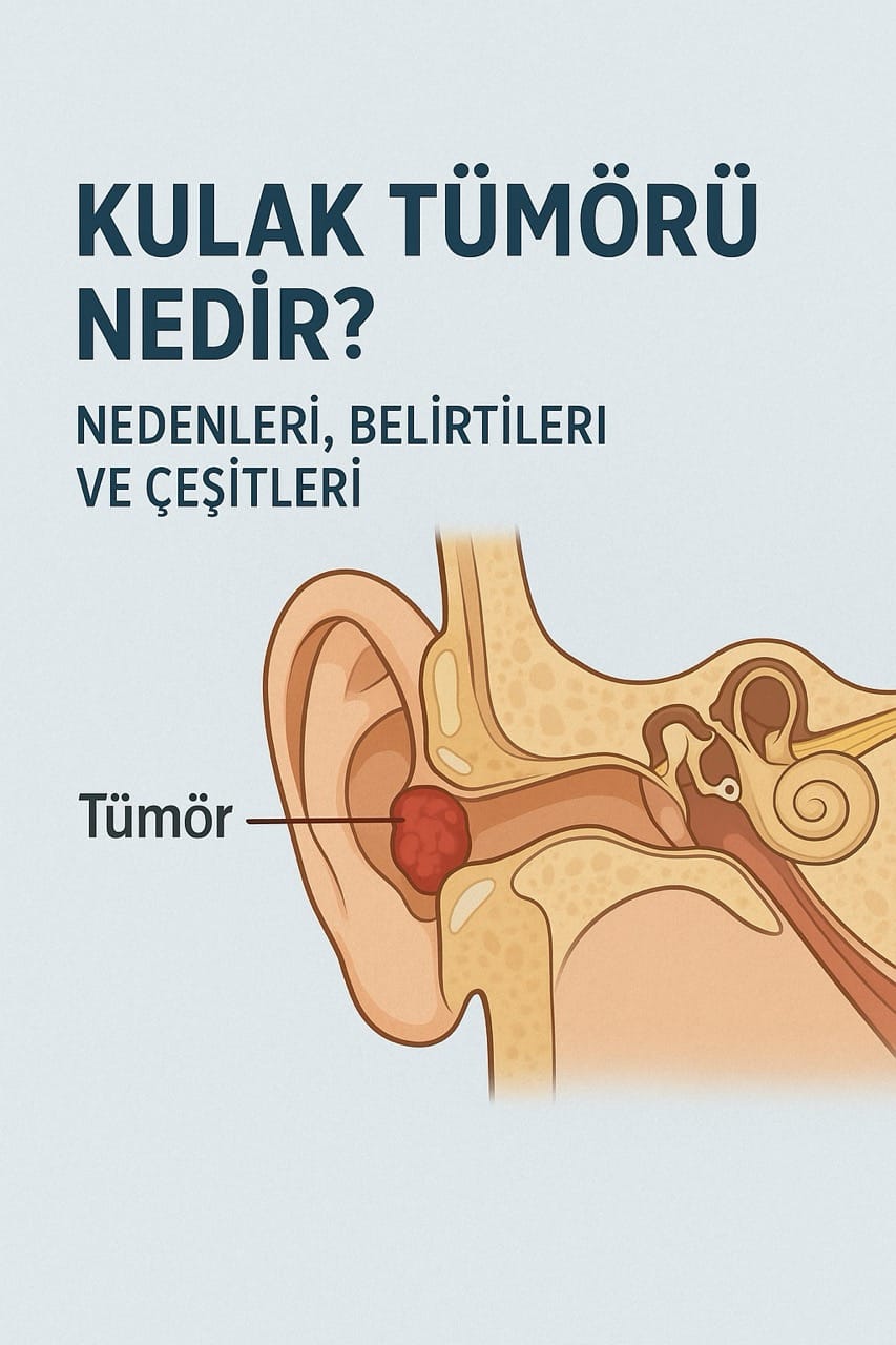 kulak tümörü nedir